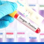 रोहतास: डेंगू की जांच की पुष्टि के लिए आवश्यक दिशा-निर्देश जारी